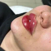 تزریق تخصصی بوتاکس و فیلر .مدل.آموزش تخصصی