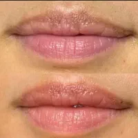 مدل با قیمت استثنایی هلچین اموزش دیدم