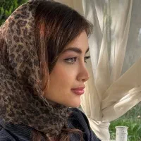 جراحی بینی ویژه مراجعین کامیاران/درتهران/43میلیون
