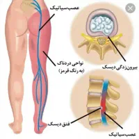 حجامت تخصصی، قلنج گیری ..