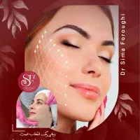 لیفت صورت با نخ (اقساط) در کرمان