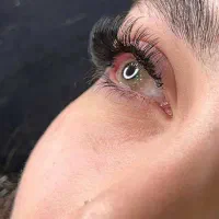 کاشت و اکستنشن مژه