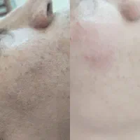 فیشال یا پاکسازی عمقی فقط259هر لک39تومان
