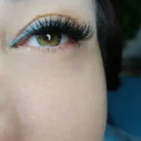 کاشت هیدن مژه