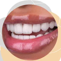 خدمات دندان پزشکی در اقساطویژه