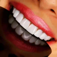افر ویژه کامپوزیت دندان با گارانتی۵۰٪تخفیف