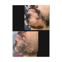 بزرگ شو|آرایشی، بهداشتی، درمانی|سلماس, |دیوار
