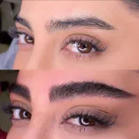 میکروبلیدینگ کرکی مویی تضمینی
