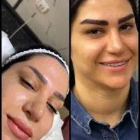 تیم تخصصی کاشت مو و ابرو و ریش میکروکاشت
