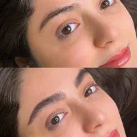 ۱۰درصدتخفیف به مناسبت روزدختر فیبروزو میکروبلیدینگ