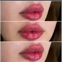 مدل ژل لب و صورت
