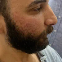 خدمات پوست