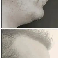 پرپشتی در ۳۰ روز