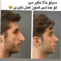 عمل بینی با فوق تخصص پلاستیک،با شرایط بدون کارمزد