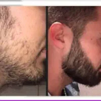 موهاتو درش بیار تو ۳۴ روز