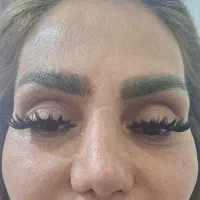 مدل کاشت مژه هیدن