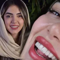 ایمپلنت اقساطی بدون پیش پرداخت درکلینیک دندانپزشکی