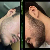 ریش دار شو