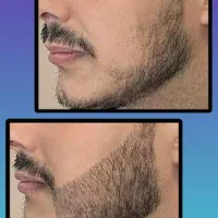 ۱۵ روز|آرایشی، بهداشتی، درمانی|قم, دورشهر|دیوار