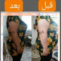 مرکزتخصصی امبدینگ لاغری با بیش از 1000رضایت