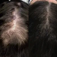 پرپشتی موهات اینجاست
