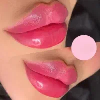 جشنواره فیلر/بوتاکس/ژل لب/لاغری غبغب