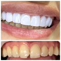 دندانپزشکی و دندانسازی دیجیتال اقساطی