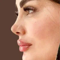 عمل بینی لیپو ابدو مامو لیفت پیکر تراشی بلفا قسطی