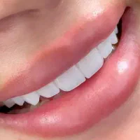 کامپوزیت کاریزما/سارمکو واحدی 2 تومن ۷سال‌ضمانت