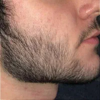 ریش و سیبیل پرپشت نمیخوای مگه