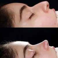 جراحی سینه و شکم و زیبایی شیراز