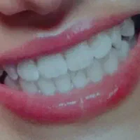 مطب پروتزدندانی نصراللهی
