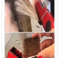 موخوره گیری مو با دستگاه و قیچی