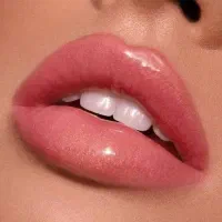 تخفیف ۷۰درصدی تزریق ژل لب-فقط پرداخت هزینه ژل