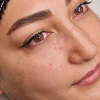 نیاز مند مدل میکرو بلیدینگ  کاملن رایگان