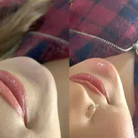 بوتاکس فیلر ژل پی آر پی آمپول لاغری جوانساز مزوژل