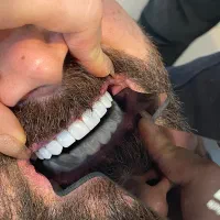 خدمات دندانپزشکی