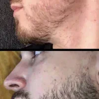 جذابیت مرد با ریش