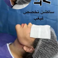 ساکشن غبغب نقد واقساط بوکال فت بلفارو کاشت ابرو|خدمات آرایشگری و زیبایی|تهران, پونک|دیوار