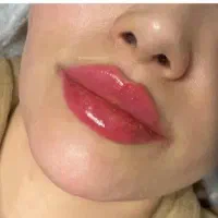 کلینیک تزریق ژل لب روسیm بوتاکس چشم گربه،لیفت،لیزر