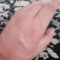 شکسته بند