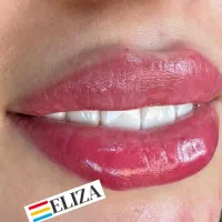 کلینیک لیزر  پوست و مو الیزا