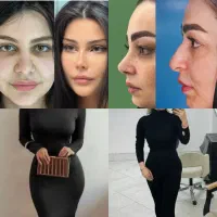 عمل جراحی زیبایی بینی لیپو۳۶۰ ابدو پیکرتراشی اقساط
