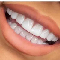 پرسلن گذار در لابراتوار