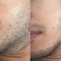 چسب ریش|آرایشی، بهداشتی، درمانی|یاسوج, |دیوار
