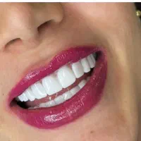 استخدام منشی و پذیرش دندانپزشکی