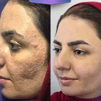 من هیچی نمیگم خودتون نگاه کنید