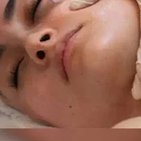 فیشیال صورت