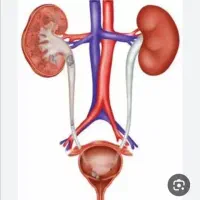 بهبود قطعی سنگ کلیه، پروستات، واریکوسل