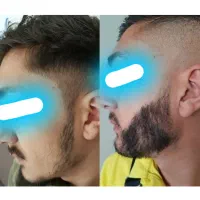 یک تغییر جذاب برای فرم و ظاهر صورت